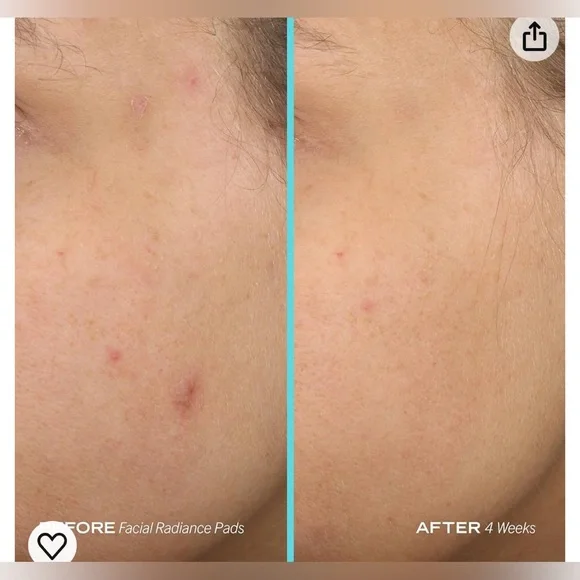 Facial Radiance Pads - Picture 6 of 7